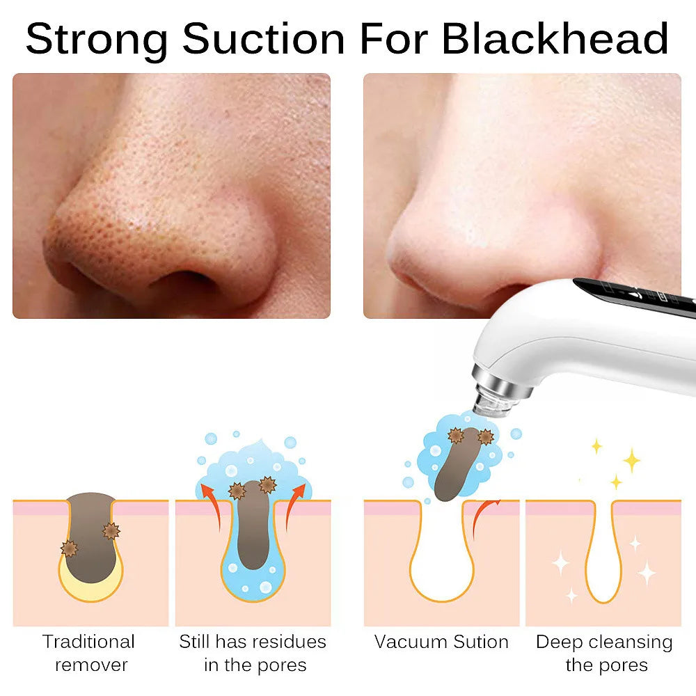 Blackhead Remover Pore Vacuum Face Cleaner Electric Pimple Black Head Removal USB Rechargeable Water Cycle Facial Cleaning Tools