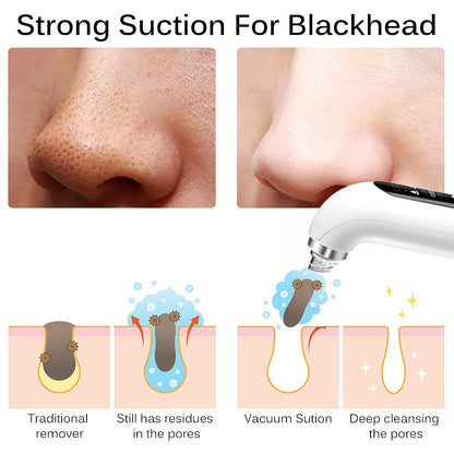 Blackhead Remover Pore Vacuum Face Cleaner Electric Pimple Black Head Removal USB Rechargeable Water Cycle Facial Cleaning Tools