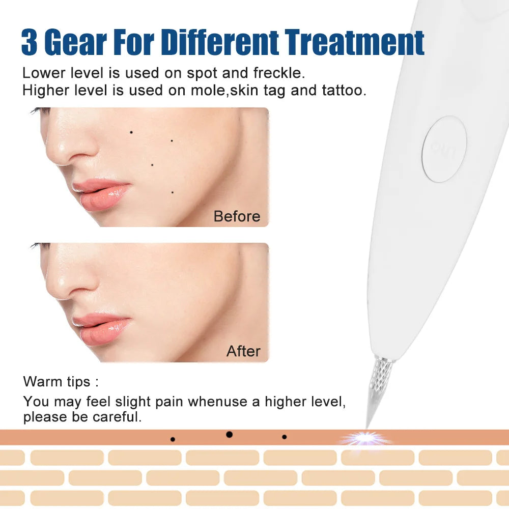 Plasma Jet Pen Professional Laser Tattoo Removal Machine Wart Mole Papilloma Face Blemish Black Dots Dark Spot Freckles Removal